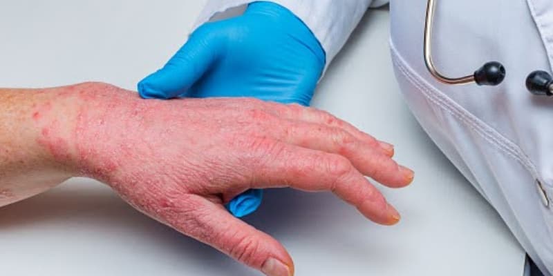 Thăm khám bác sĩ da liễu kịp thời